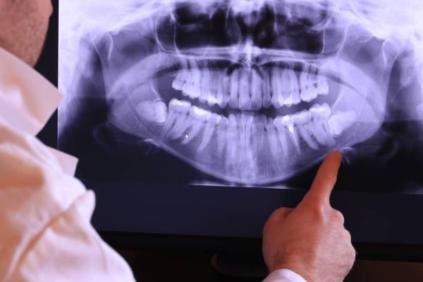Best Emergency Treatment for Toothache in , MS